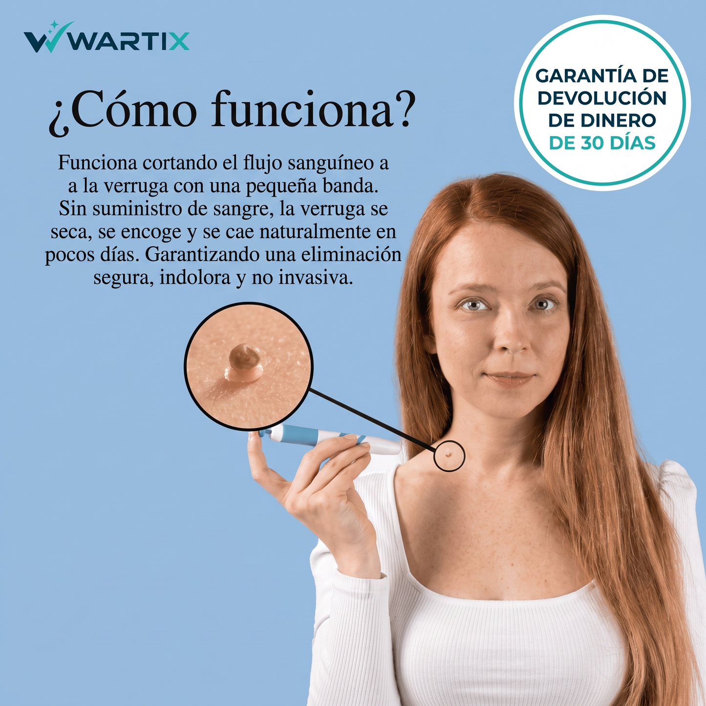 Eliminador de Verrugas sin Dolor
