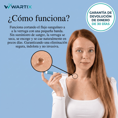 Eliminador de Verrugas sin Dolor